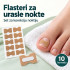 Set flastera za korekciju uraslih noktiju