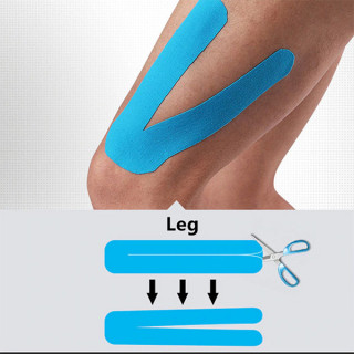 Kinesiologi tape - sportska traka protiv povreda