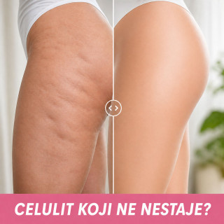 Ručni anticelulit masažer – za glatku i zategnutu kožu