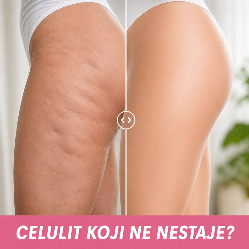 Ručni anticelulit masažer – za glatku i zategnutu kožu