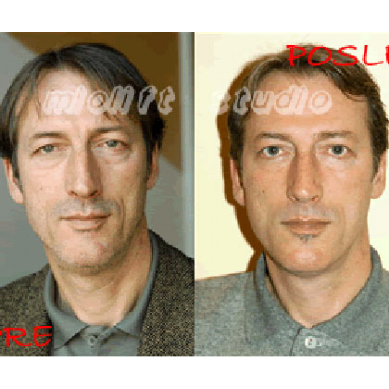 Beauty Defect Repair tretman lica