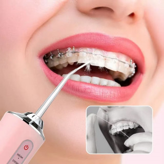 Oralni irigator - Aparat za efikasno čišćenje desni i zuba