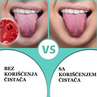 Tongue Scraper - Čistač jezika za svež dah