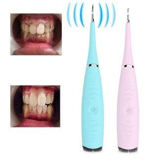 Tooth Cleaner - Prenosivi čistač zuba