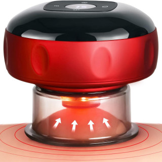 Smart Cupping – Pametni masažer za dubinsko opuštanje mišića