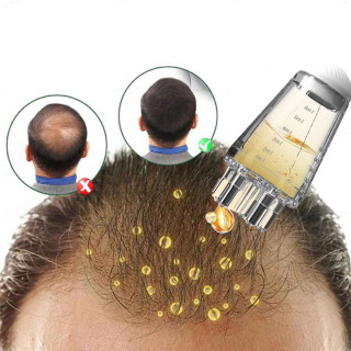 Masažni aplikator losiona i seruma protiv opadanja kose