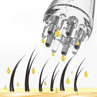 Masažni aplikator losiona i seruma protiv opadanja kose