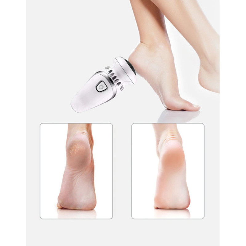 Pedi Air - Električna turpija za besprekornu kožu stopala