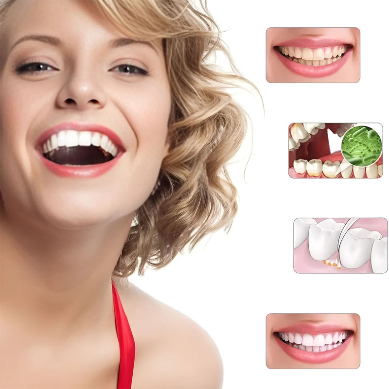 Spin Smile 360 - Profesionalni uređaj za poliranje zuba