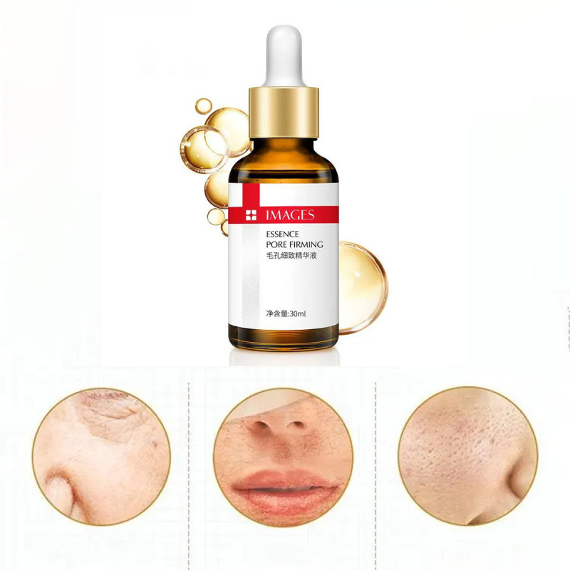 Serum za negu kože lica - za rešavanje pora i masne kože