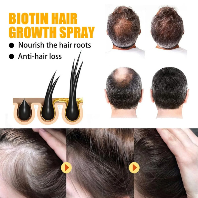 Biotin serum za rast kose - nega u spreju