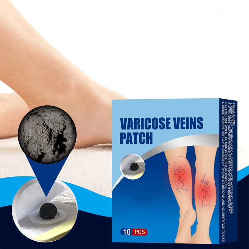 Flasteri za proširene vene i cirkulaciju