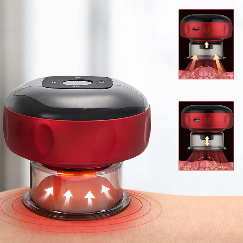 Smart Cupping – Pametni masažer za dubinsko opuštanje mišića