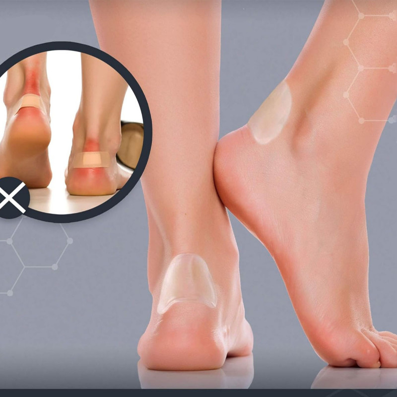 Gel flaster za žuljeve – Korak bez bola