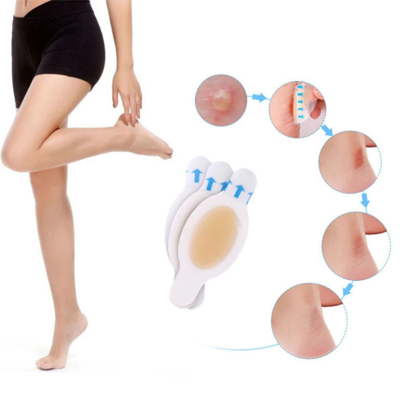 Gel flaster za žuljeve – Korak bez bola