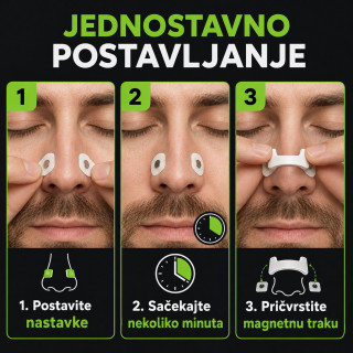 Magnetne trakice za lakše disanje kroz nos –  Spoljašnji dilatator set za 15 dana