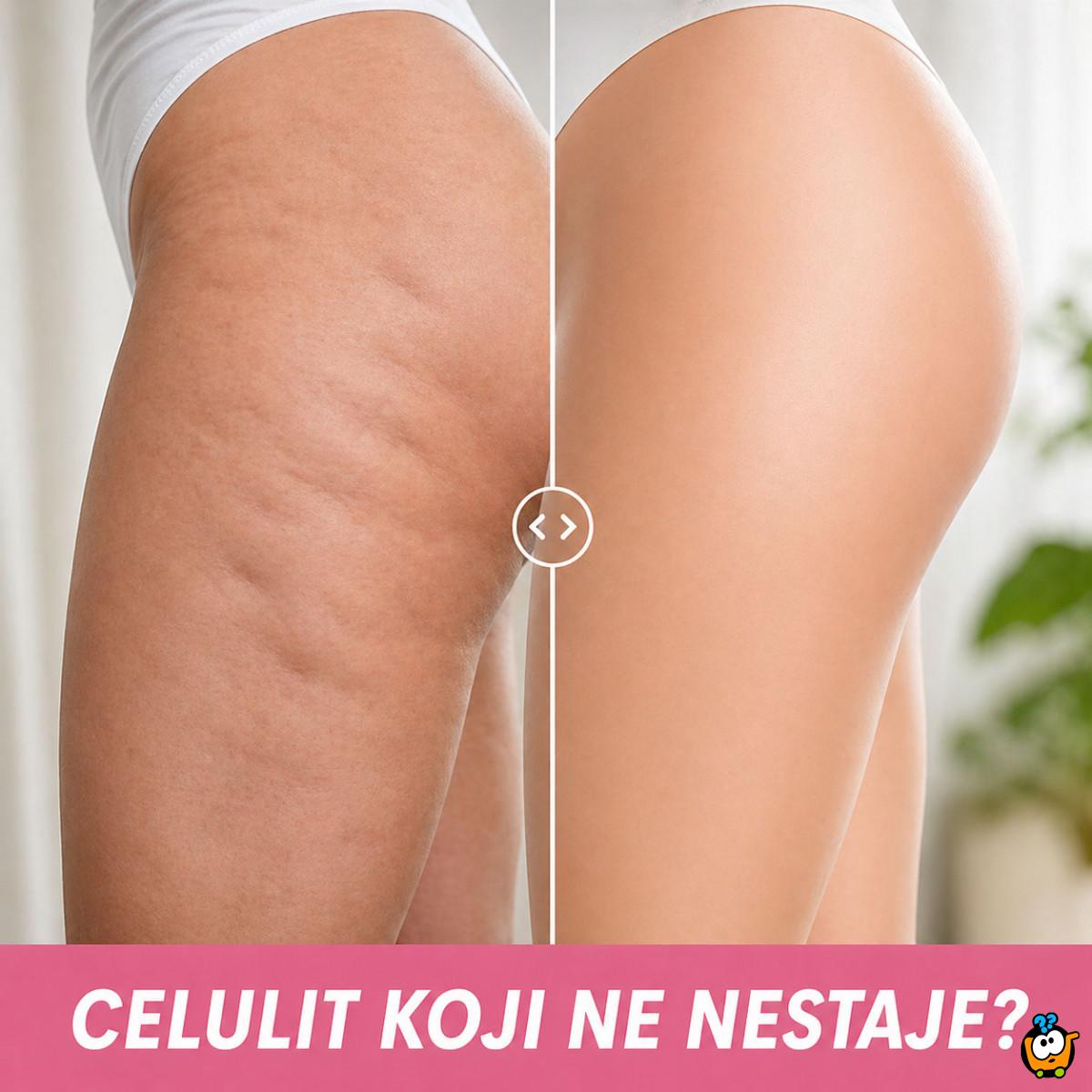 Ručni anticelulit masažer – za glatku i zategnutu kožu