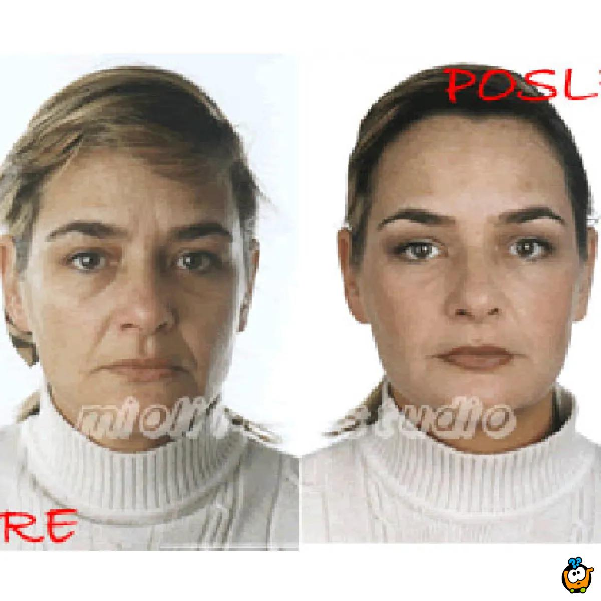 Beauty Defect Repair tretman lica