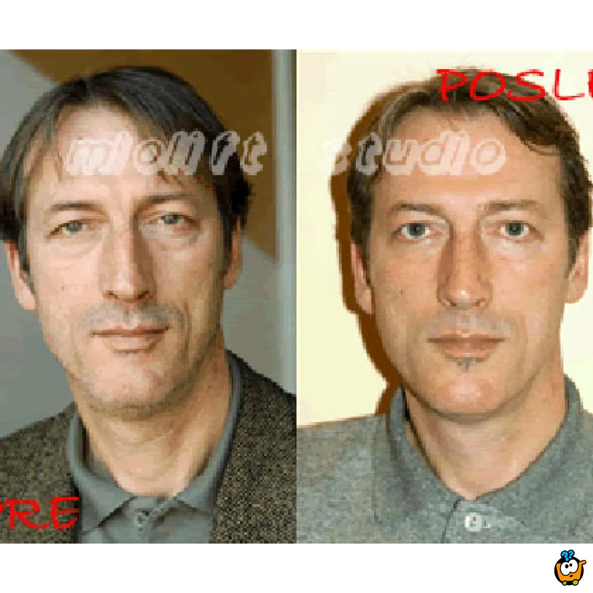 Beauty Defect Repair tretman lica