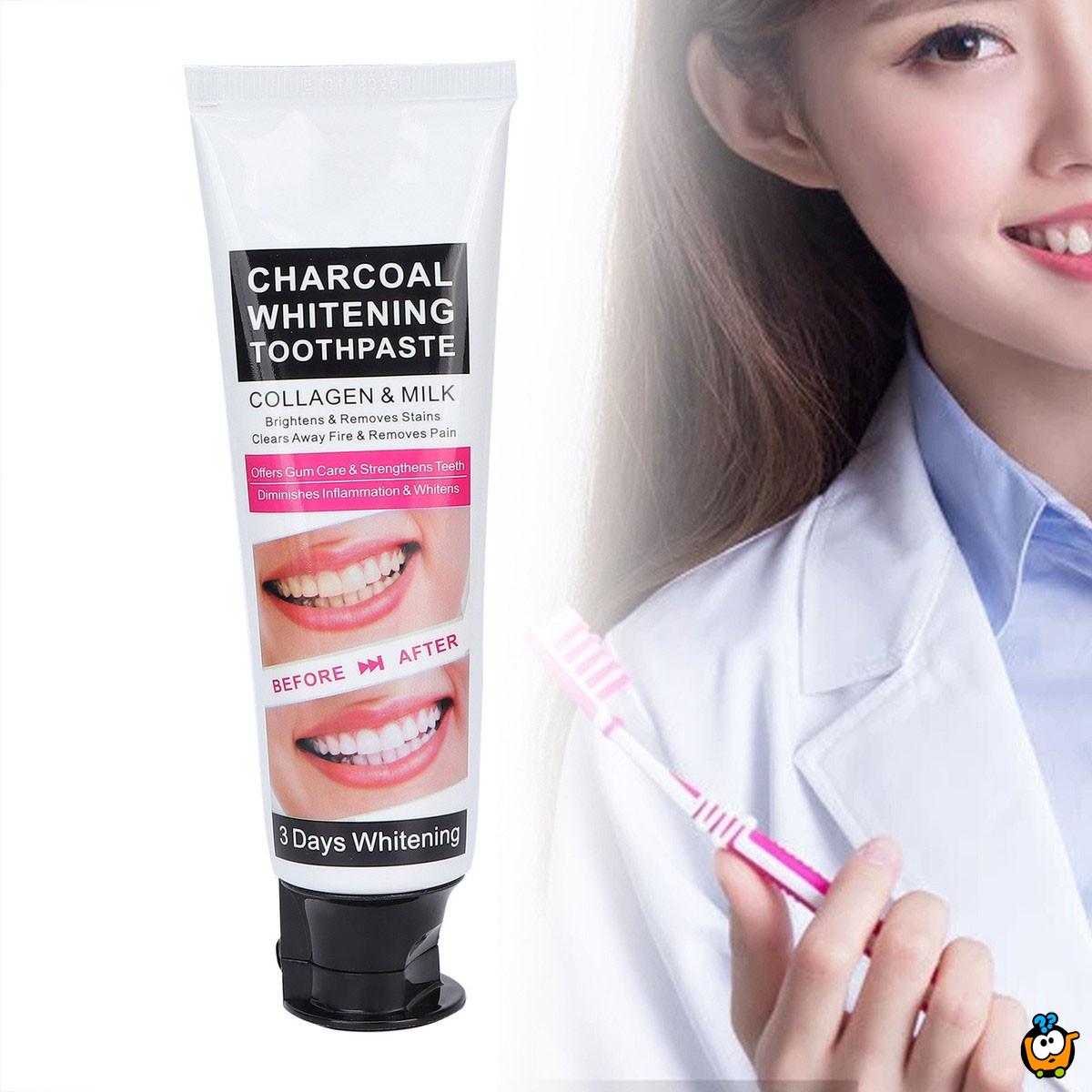 Pasta za izbeljivanje zuba sa aktivnim ugljem