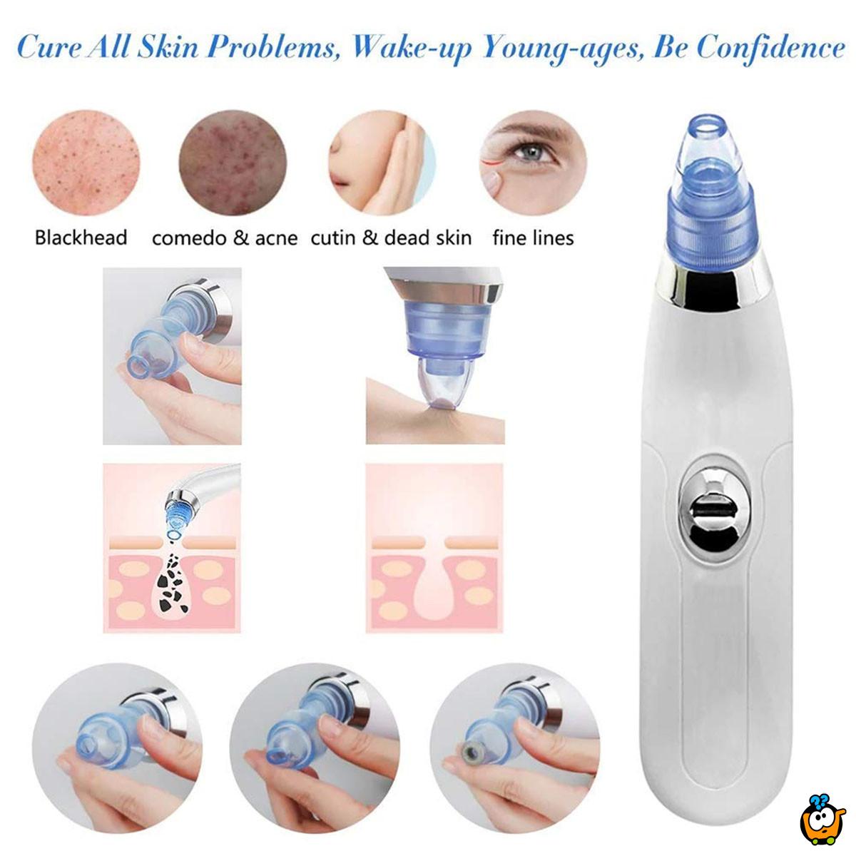 Vakum aparat za čišćenje mitisera