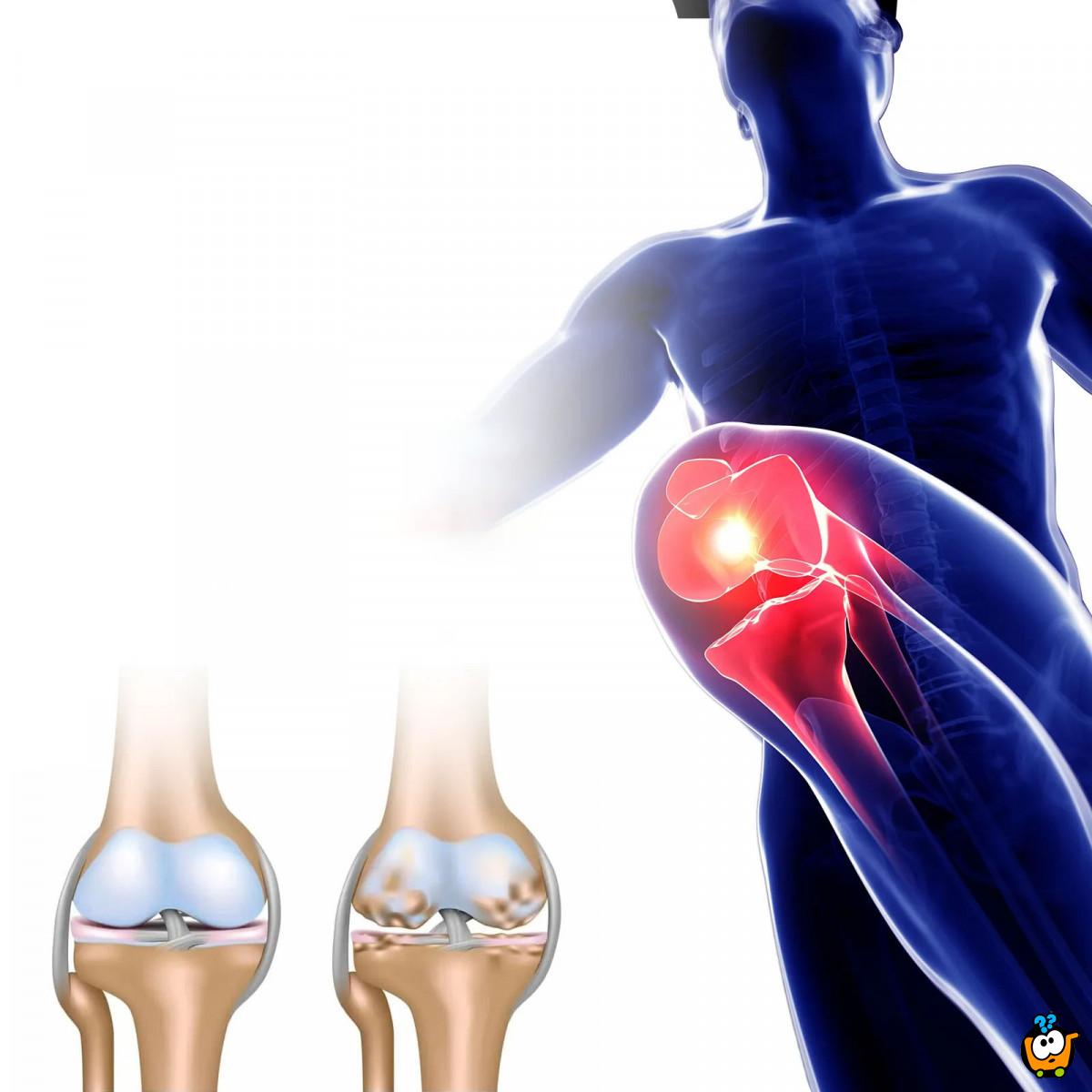 Arthritis Cream – krema protiv bolova u zglobovima
