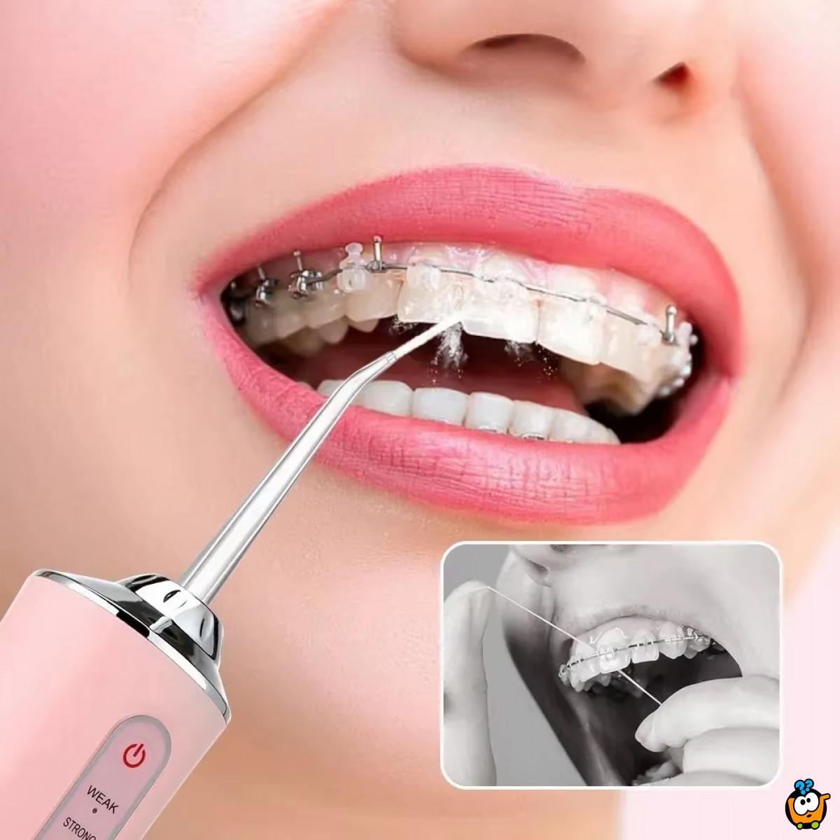 Oralni irigator - Aparat za efikasno čišćenje desni i zuba