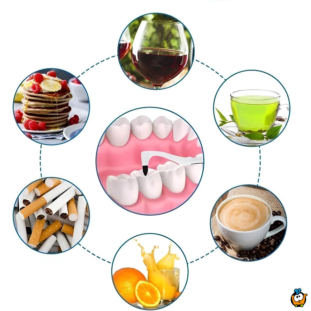 Spin Smile 360 - Profesionalni uređaj za poliranje zuba