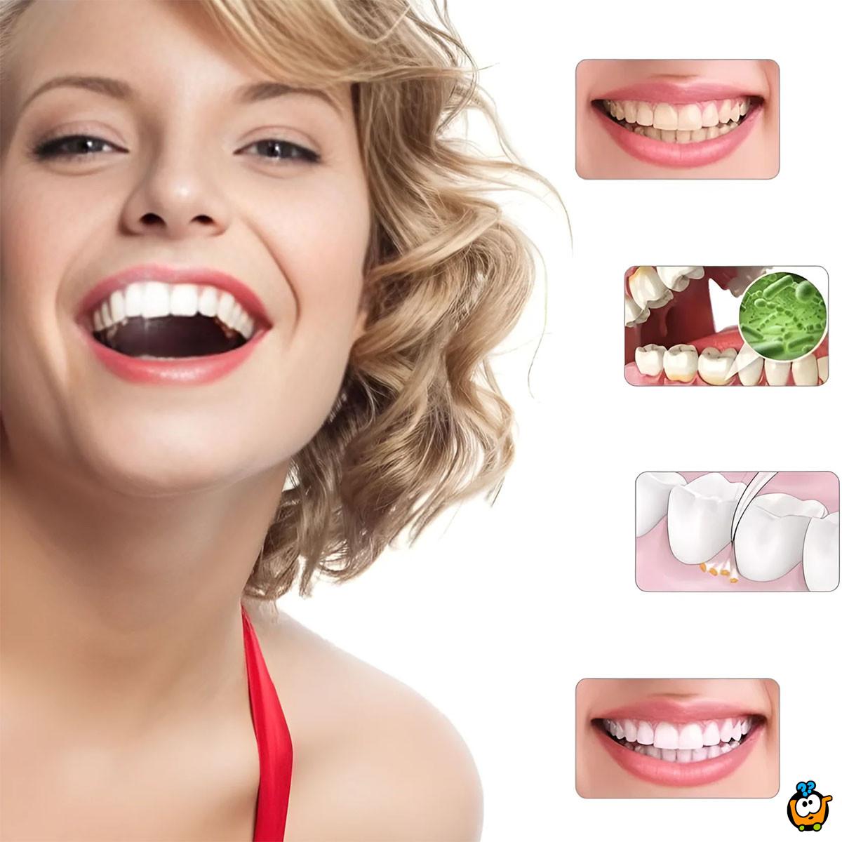 Spin Smile 360 - Profesionalni uređaj za poliranje zuba