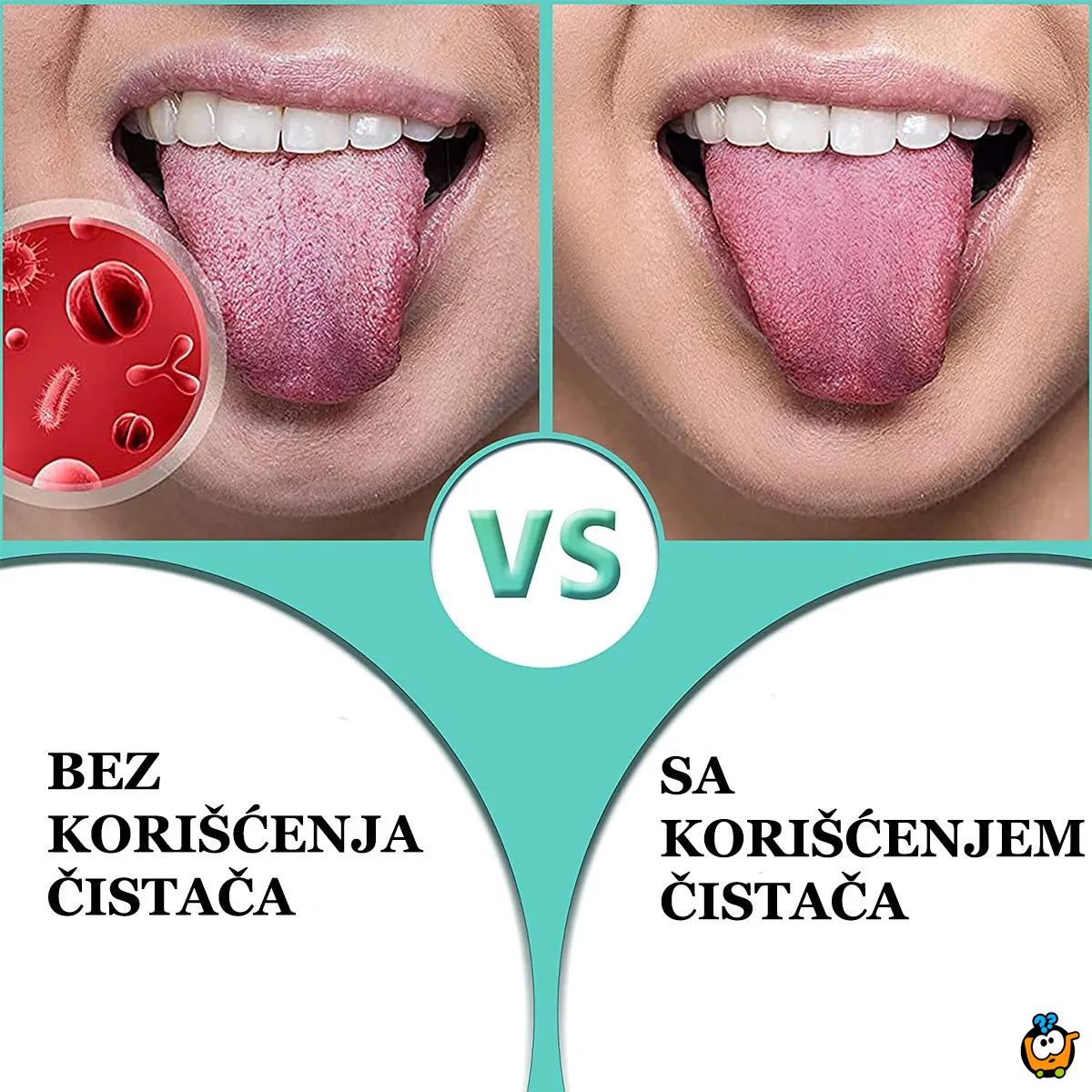 Tongue Scraper - Čistač jezika za svež dah