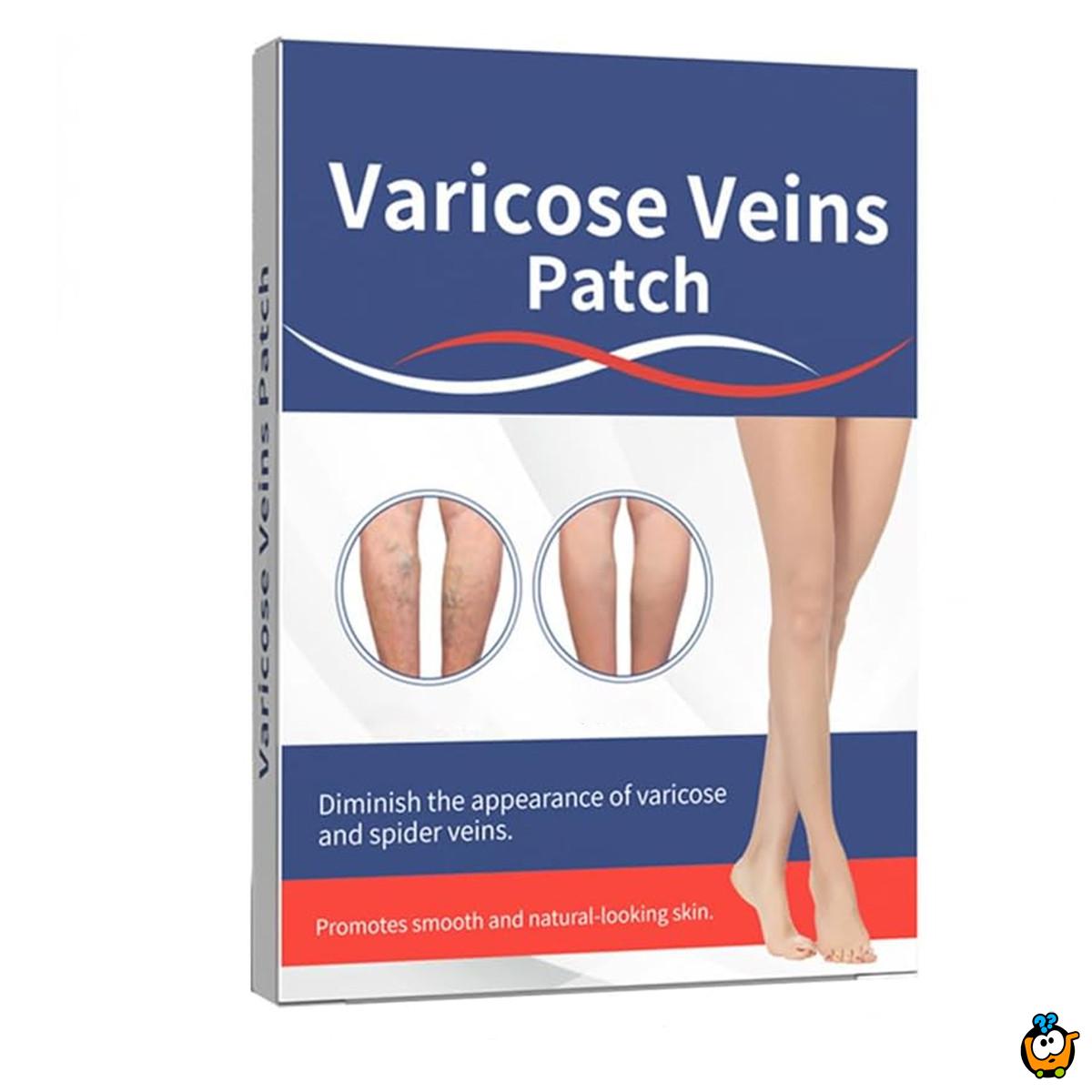 Flaster za proširene vene i lošu cirkulaciju