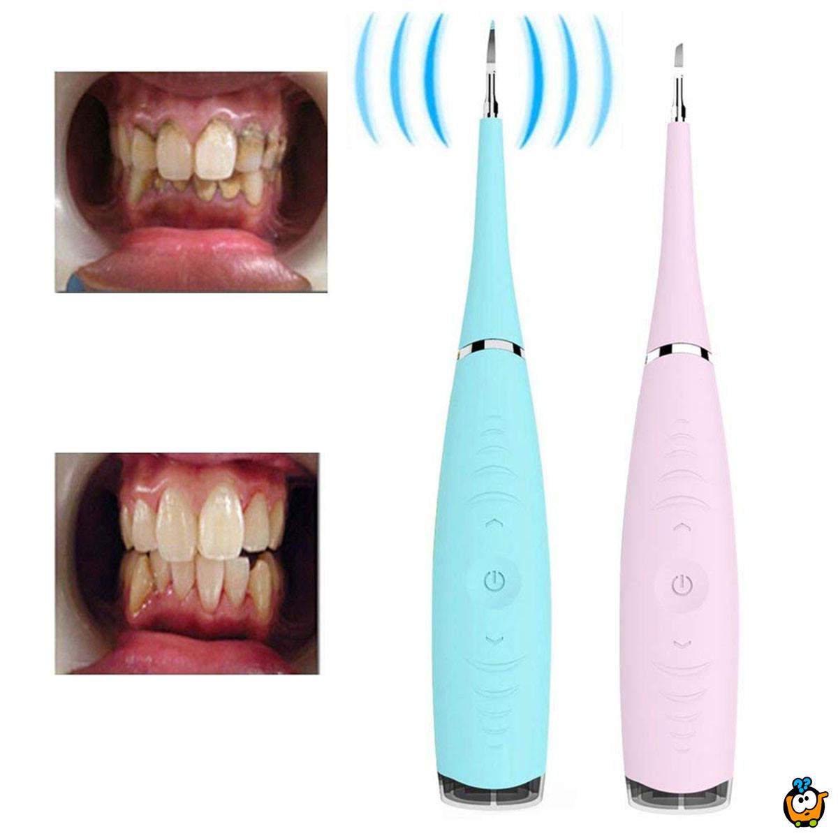 Tooth Cleaner - Prenosivi čistač zuba