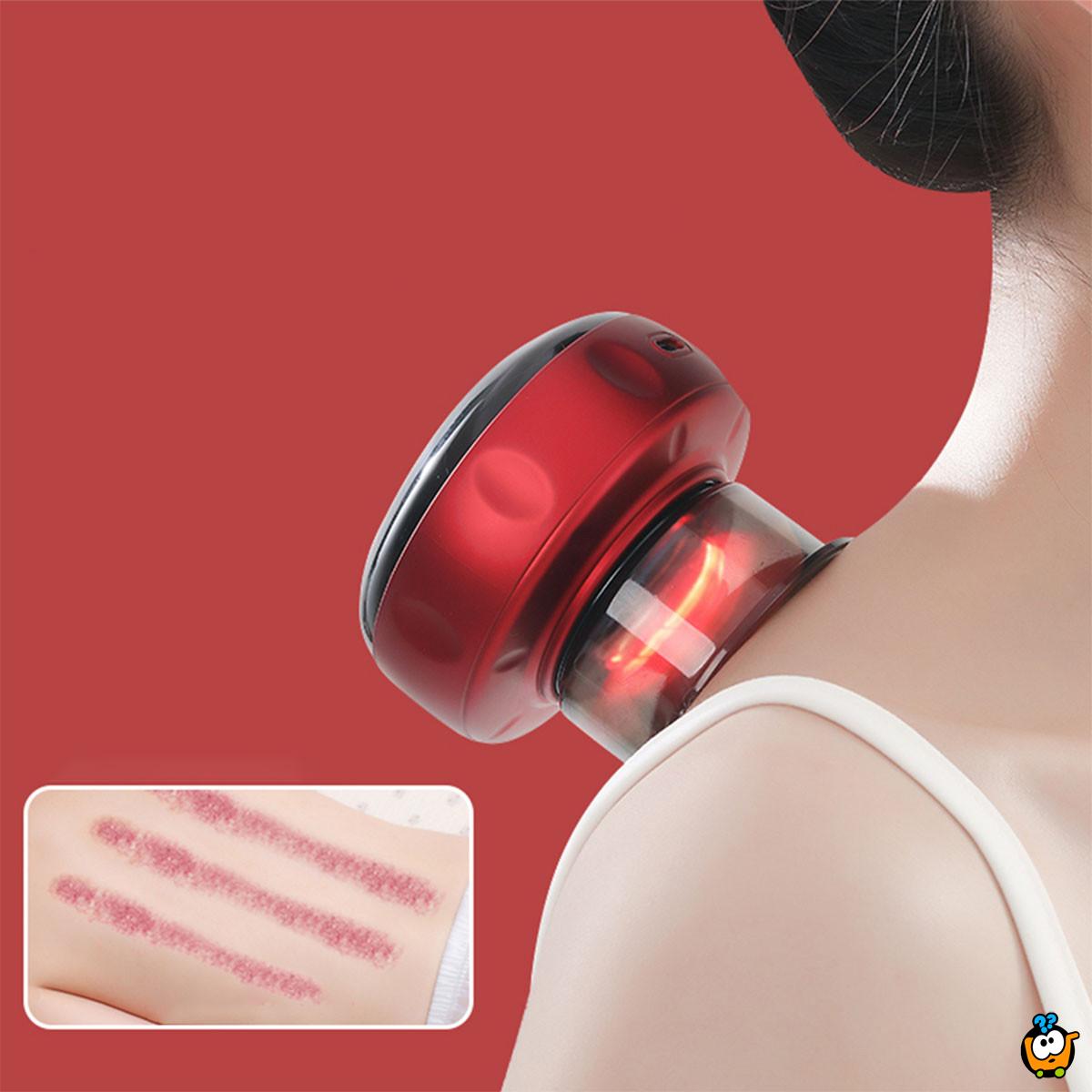 Smart Cupping – Pametni masažer za dubinsko opuštanje mišića