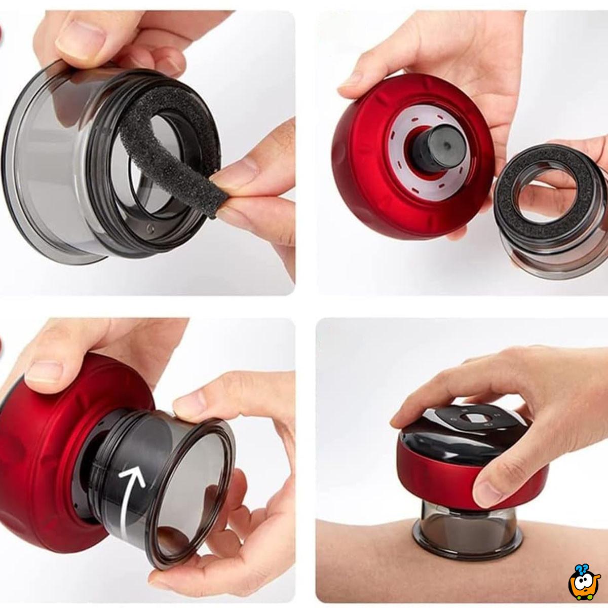 Smart Cupping – Pametni masažer za dubinsko opuštanje mišića