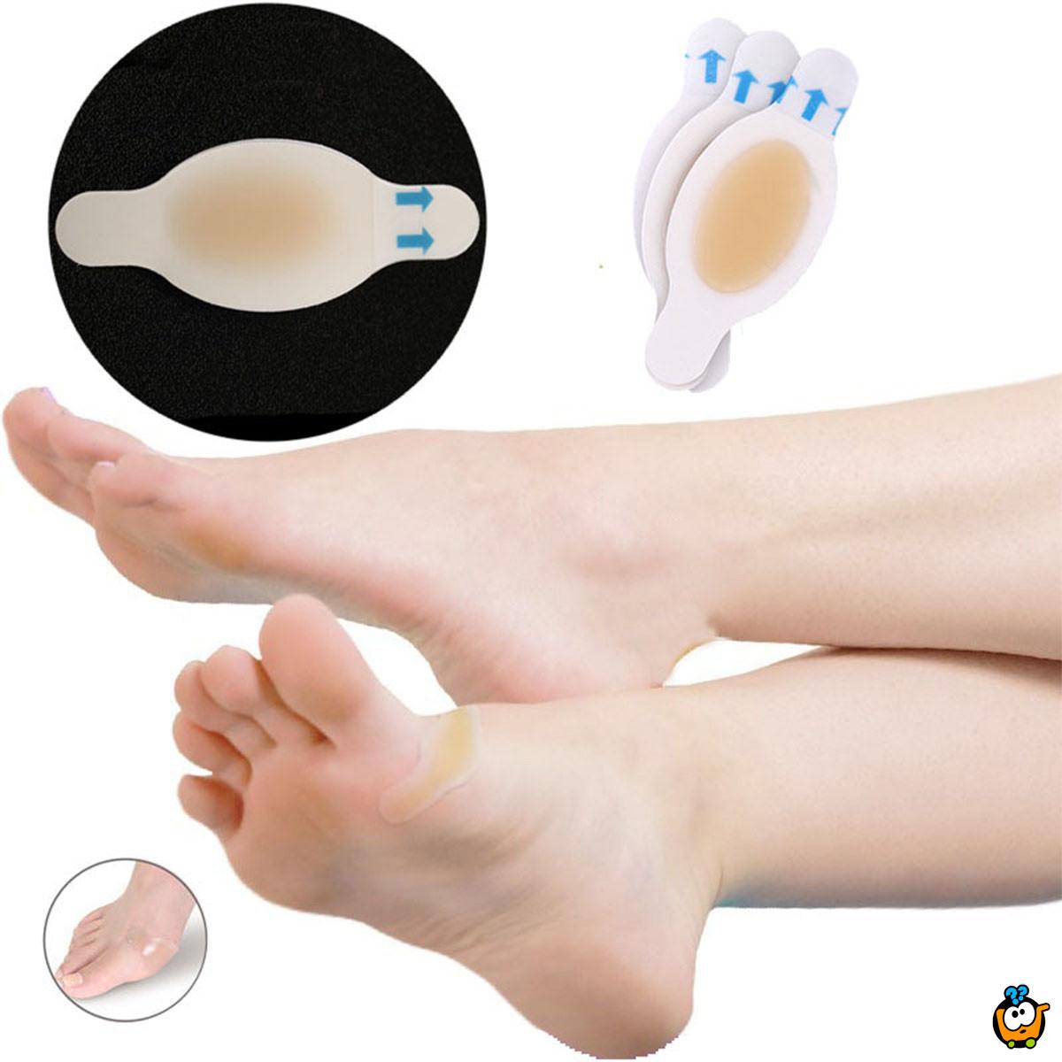 Gel flaster za žuljeve – Korak bez bola