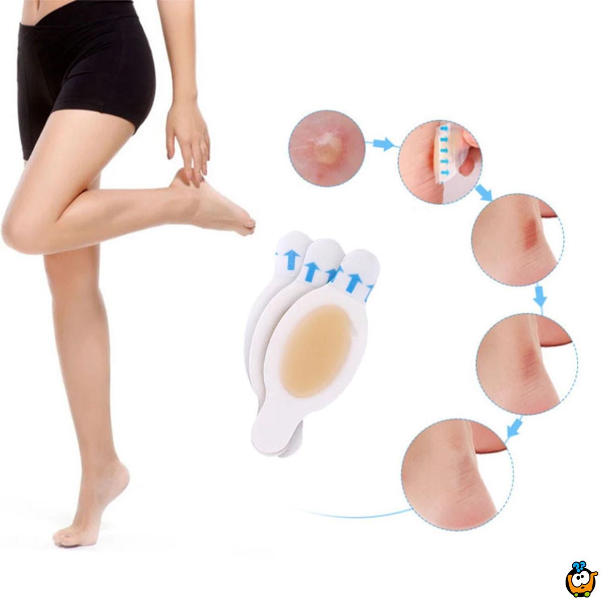Gel flaster za žuljeve – Korak bez bola
