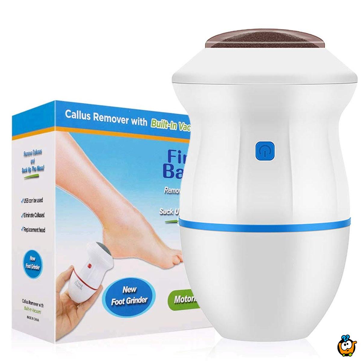 Električni odstranjivač žuljeva – Besprekorno glatka stopala