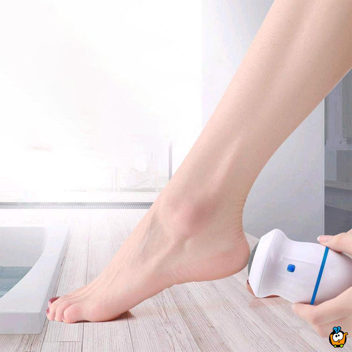 Električni odstranjivač žuljeva – Besprekorno glatka stopala