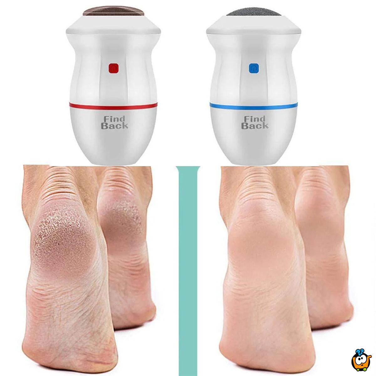 Električni odstranjivač žuljeva – Besprekorno glatka stopala